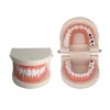Adult pathology standard dental teaching with caries tooth model