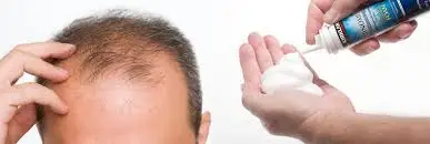 Minoxidil2.jpg