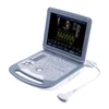 Notebook Color Doppler Ultrasound Scanner WT-6800