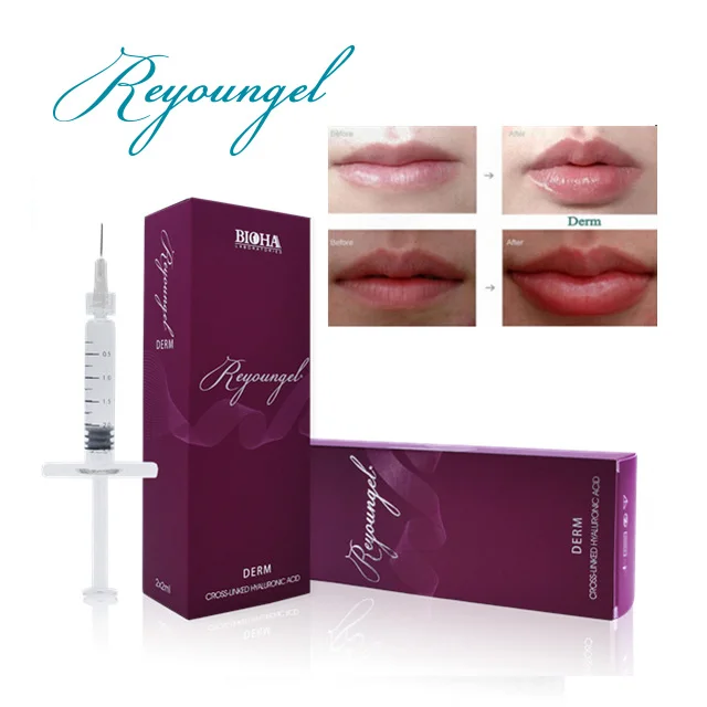 
Reyoungel Hyaluronate Acid Lip Fullness Ha Dermal Filler 2ml 