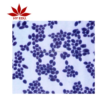 Kit De 50 Tipos De Fungos E Bacterias Celulas De Microrganismos Microscopio Preparado Slides De Microbiologia Para Educacao De Biologia Buy Slides De Microbiologia Para Educacao E Universidade Slides De Bacterias Diferentes