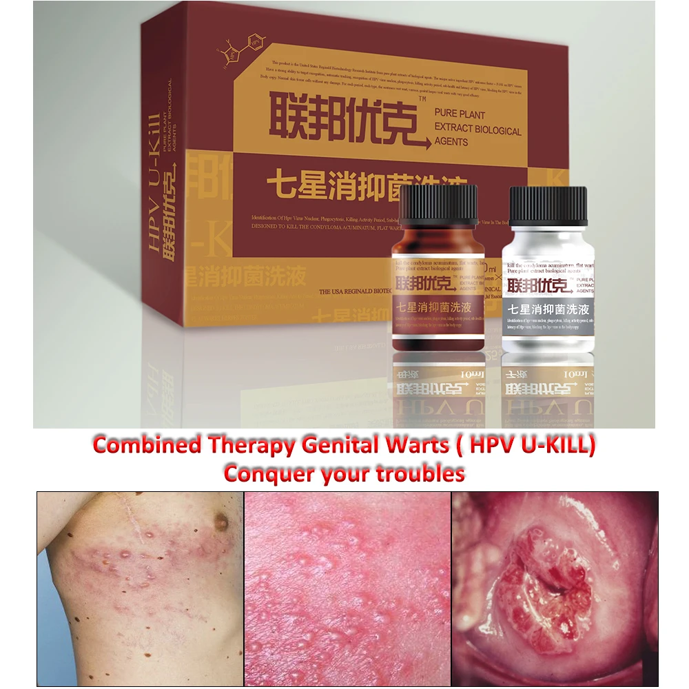 批發草本普通疣尖銳溼疣 hpv 疾病自然治療 odm/oem/私人標籤