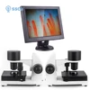 LCD Digital Microcirculation Microscope