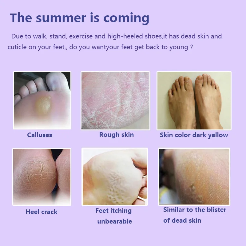 
Free Shipping Wholesale Exfoliating Foot Peel Mask Lavender Exfoliating Socks Baby Care Pedicure Socks Remove Dead Skin 