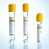 Medical disposable gel & clot activator tube glass pet bd vacutainer vacuum blood collection tubes