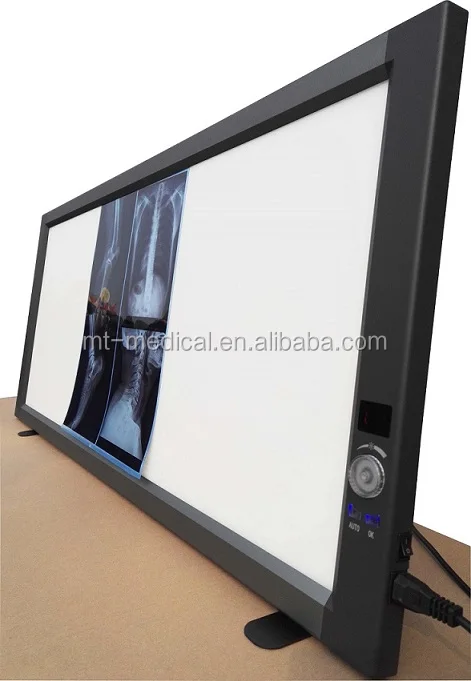 High quality LED X-ray viewer box for medical use, made in China