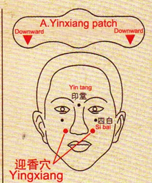 Nasal patch перевод. Rhinitis Patch Sumifun.
