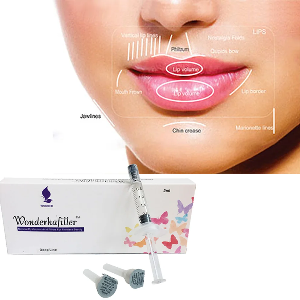 

fillers lips 2ml deep hyaluronic acid injection for lip fullness