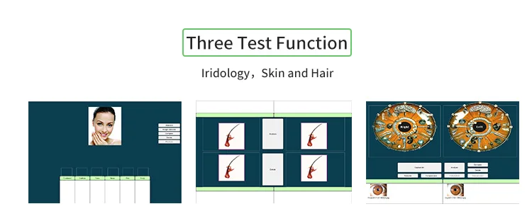 Latest version pro software iridology camera eye iriscope
