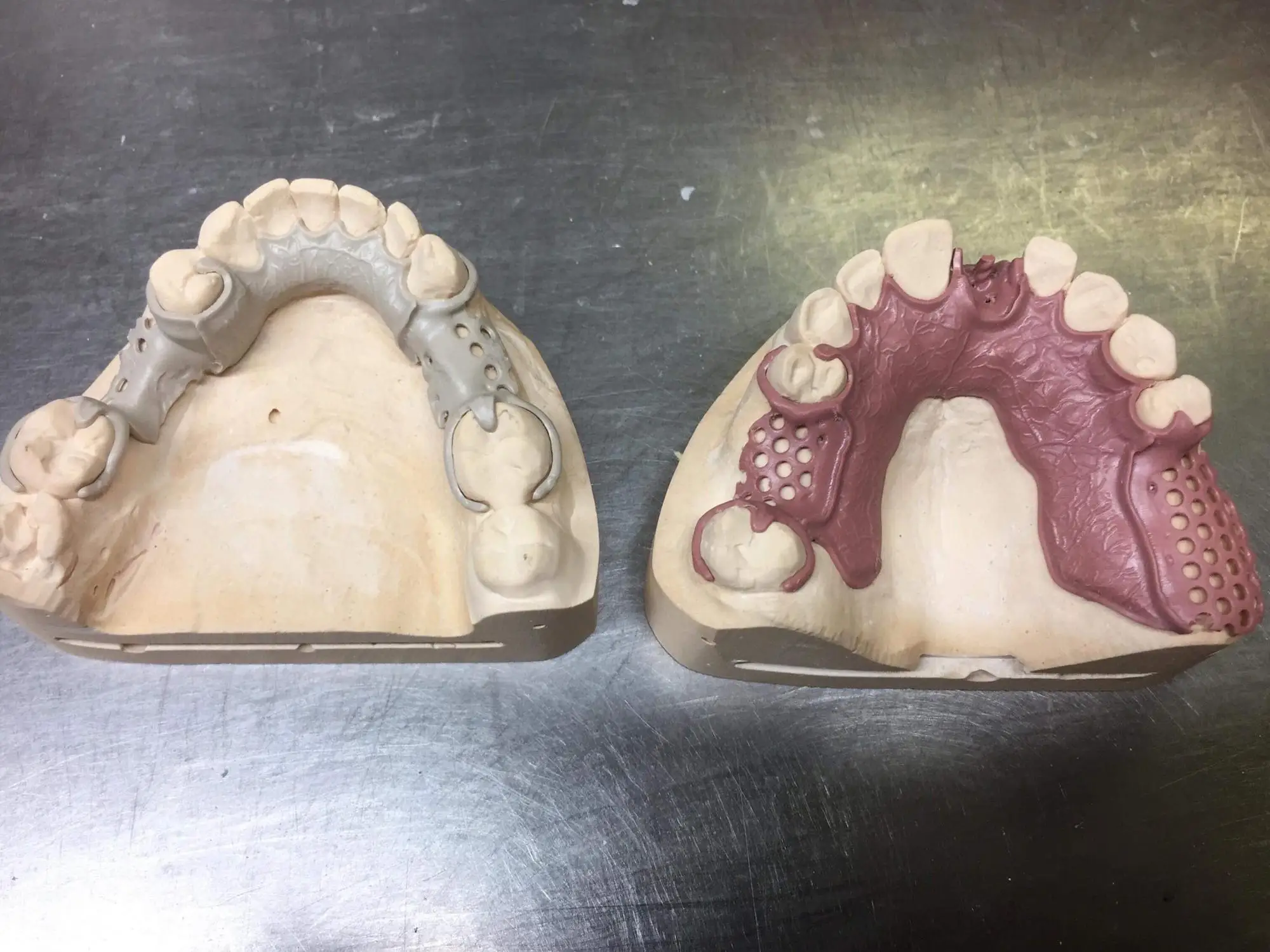 Конструкционные материалы в ортопедической стоматологии