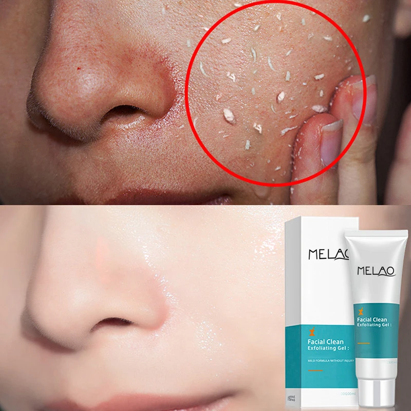 

Melao Exfoliante Peeling Face Body Dead Skin Remover Organic exfoliator Moisturizing Whitening Aloe Vera Facial Exfoliating Gel