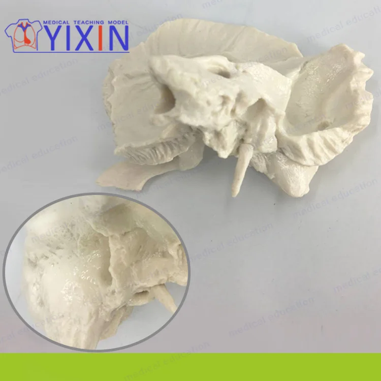 
Advanced Human Temporal Bone Anatomical Magnification Model, Medical Science and Education Model, Human Temporal Bone Magnificat 