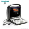 New hot sale medical use ultrassonografia sonographer ultrasound imaging machine