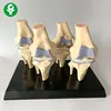 High quality PVC Transparent human Stage 4 knee joint model for studying human skeletal model
