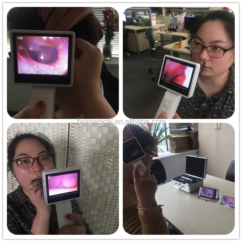 960x480 高分辨率视频耳镜手持耳镜