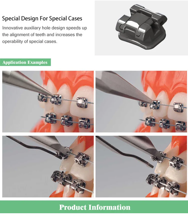 Self Ligature Bracket,Orthodontic Metallic Self Ligating Brackets