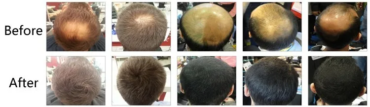 Oem Service Private Label Natural Keratin Hair Building Fibers For