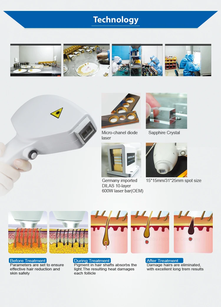 CE approved permanent hair removal by laser diodo 808 (2).jpg