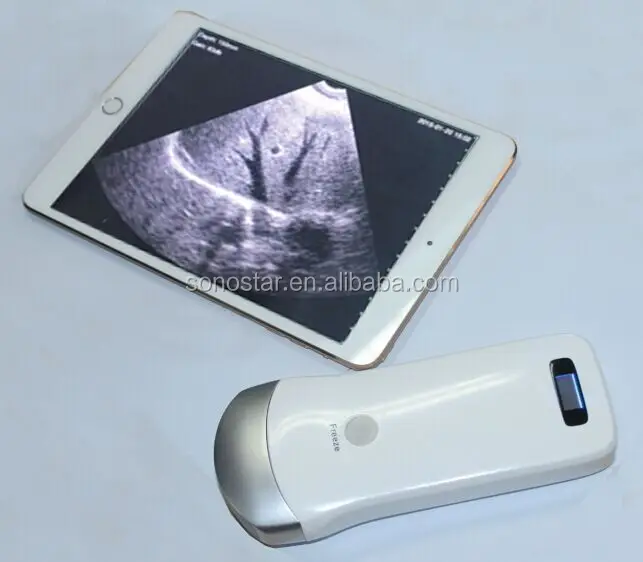 Uprobe2 Wireless Probe Ipad Ultrasound Scanner For Sale Buy Tablet