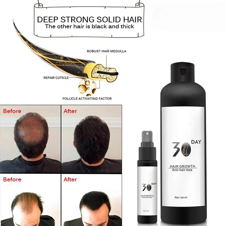 hair growth oil