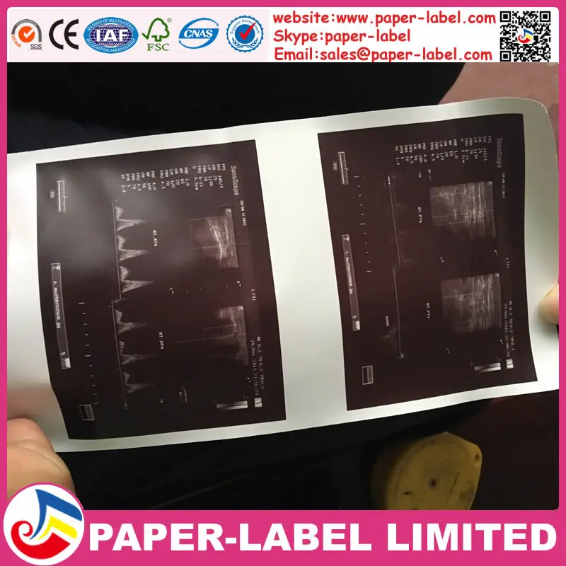 High light thermal printing paper use for hospital Sony UPP-110S/UPP-110HG