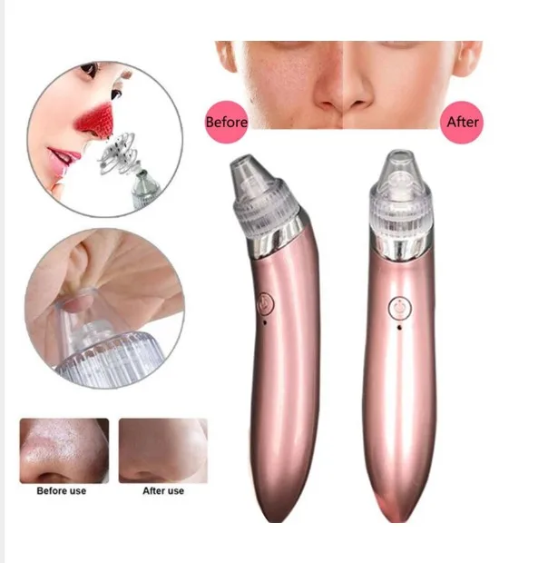 

new trending products nose strips vacuum suction blackhead remover vacuum, White rose gold