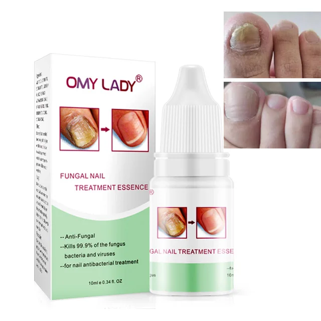 

omy lady high quality anti fungal nail treatment toe nail repair oil, Clear