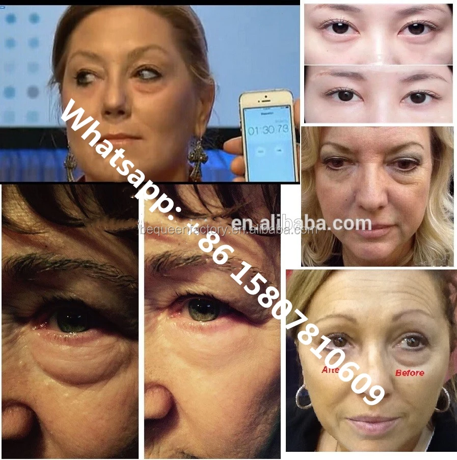 Korean Caviar Eye Bag Removal Cream For Dark Circle Remove Buy Caviar Eye Cream,Korean Eye Bag