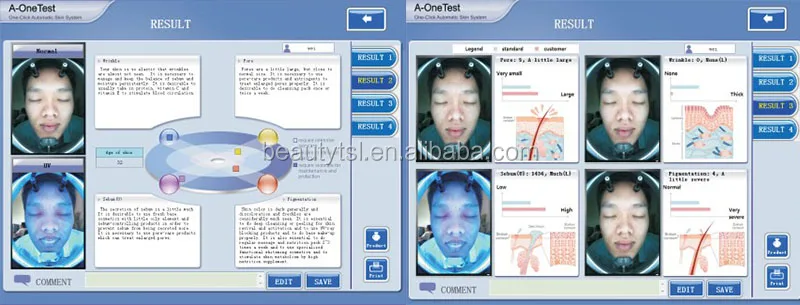 M8000 skin analyzer 3