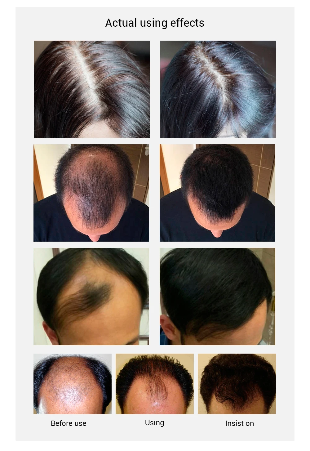 Lanbena Natural Hair Growth Essence Spray For Bald Head Buy Hair