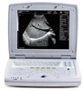 MCU-K500 Full Digital Color Doppler Ultrasound scanner