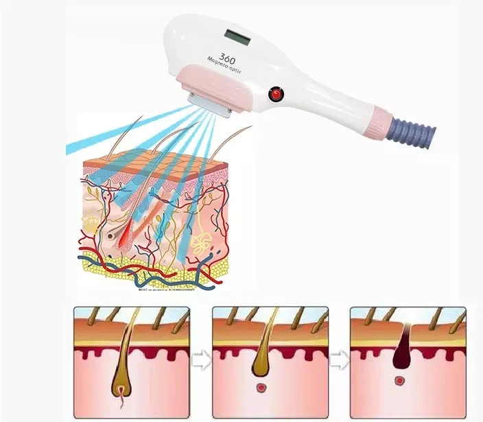 New Products 360 Magneto-optic Hair Removal Machine OPT Freezing Point Painless Hair Remover Machine