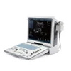Portable Mindray ultrasound price mindray dp50/mindary ultrasound