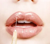

5.0ml/syringe Cross Linked Hyaluronic Acid Gel Injection for lip enhancer