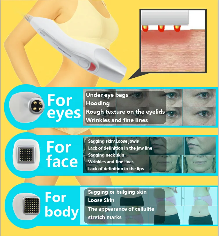 franctional RF machine  5