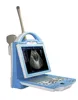 Portable ultrasound machine/scanner price with many advantages humanized design,powerful data management,abundant softwares
