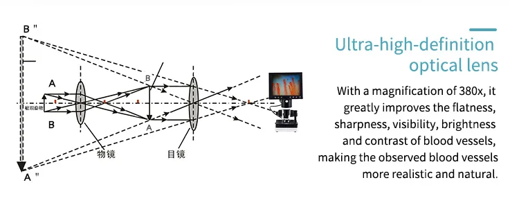 Di động video nail gấp mao mạch vi tuần hoàn kính hiển vi