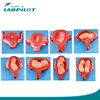 106 Marks Deluxe Fetus Development Model, Pregnant Uterus Model