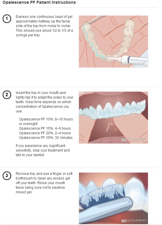 Different Tasts Cheap Home Use Opalescence Tooth Whitening Systems