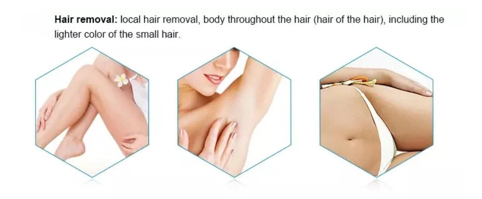 opt ipl rf nd yag best laser hair removal and skin rejuvenation machine magneto optic