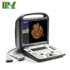 High performance cost ratio ultrasound sonoscape S6/Cardiac Doppler Ultrasound/Cardiac Echo Machine