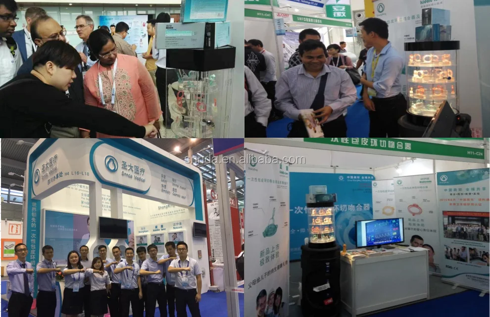 shang ring circumcision device