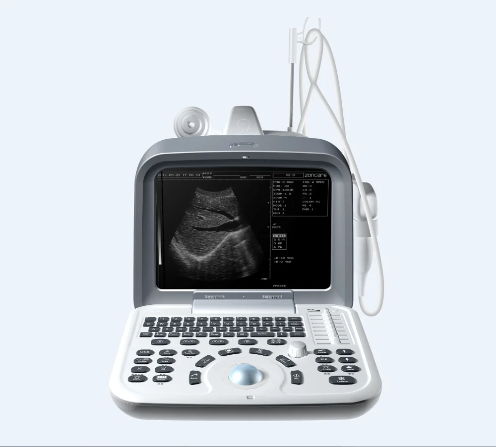 Portable Devices Micro-convex Ultrasonic Scanner Ultrasonic Diagnostic Scanner