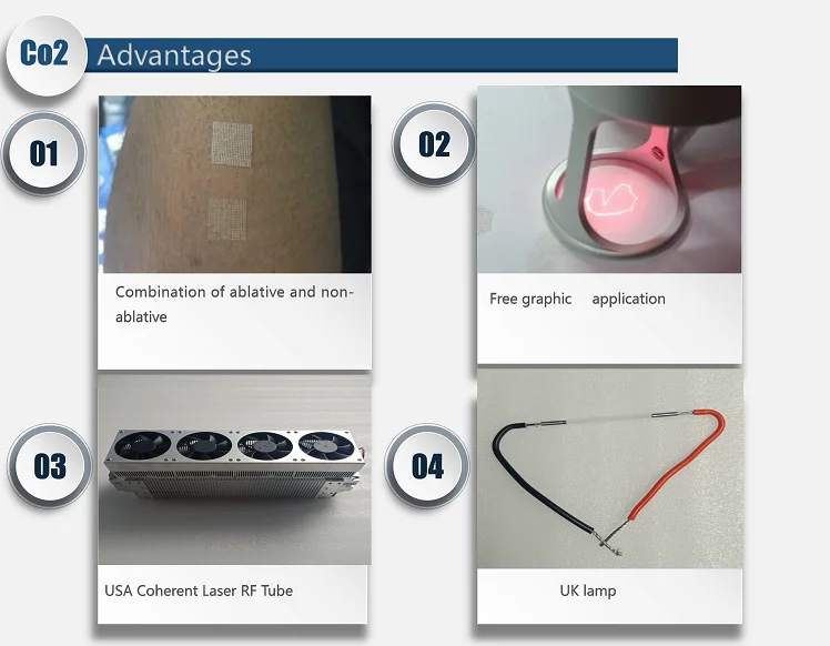 Pentagon Rf Co2 Fractional Laser With 1540nm And Free Graphics