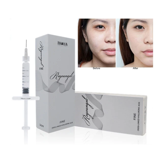 
Reyoungel Cross-linked acid hialuronico Injectable Filler For Rhinoplasty 