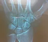 kodak chemical thermal dry image,medical lab test equipment,fuji medical x-ray film of medical material