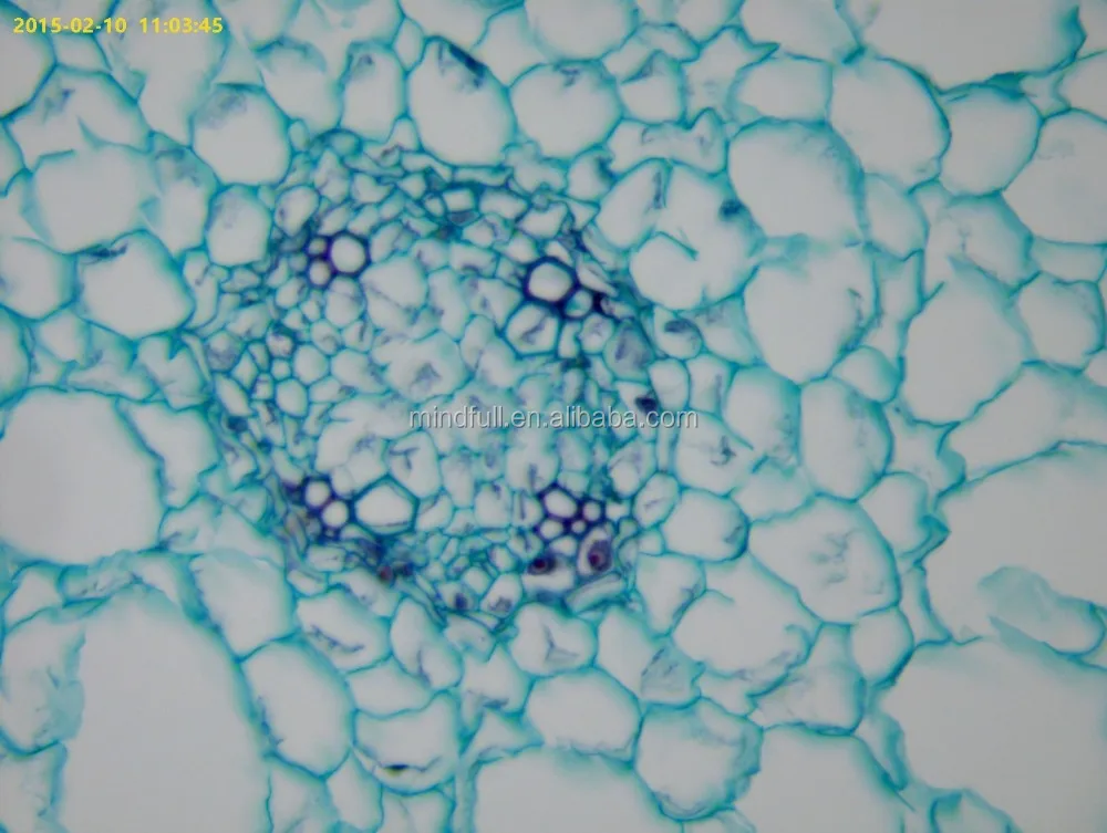 1_Typical_dicot_root_ranunculus_mature_root_cs (2).jpg