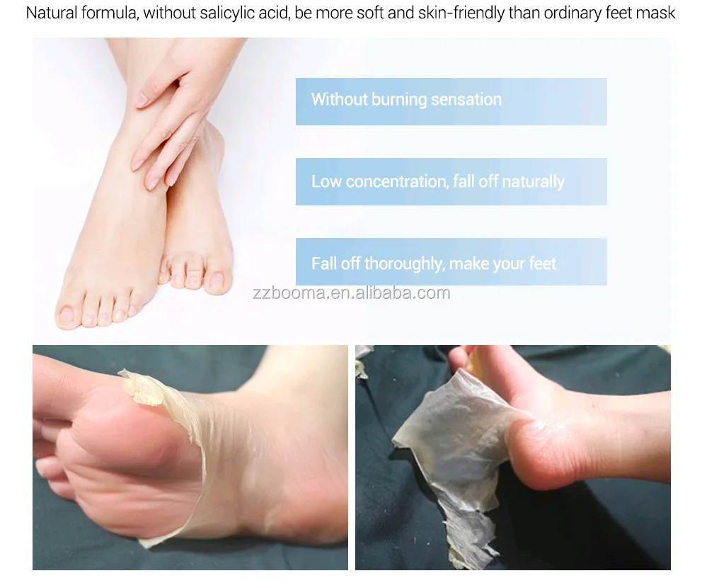 Foot Skin Care Solution Dead Remover Chemical Exfoliapeeling Foot Mask
