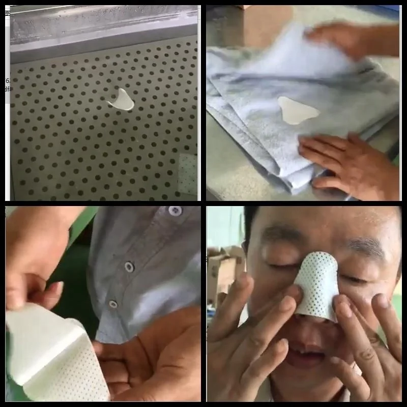 вазомоторный ринит септопластика. тампоны кровоостанавливающие носовые. силиконовые сплинты в нос. турунды и тампоны. тампоны после септопластики.