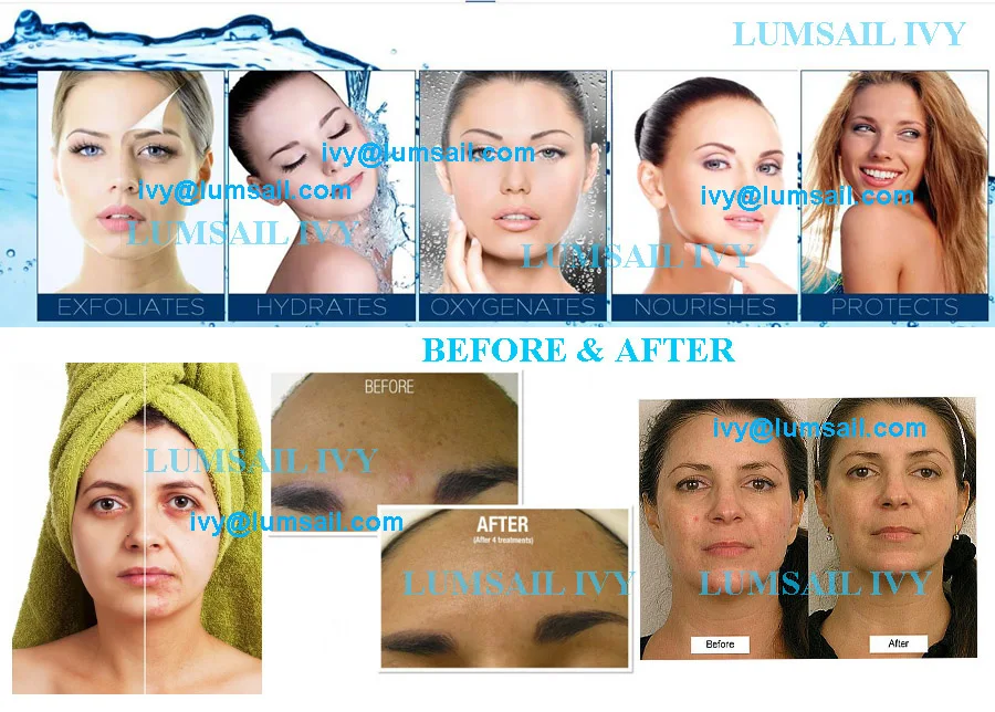 8 in one machine medical practitioner micro dermabrasion